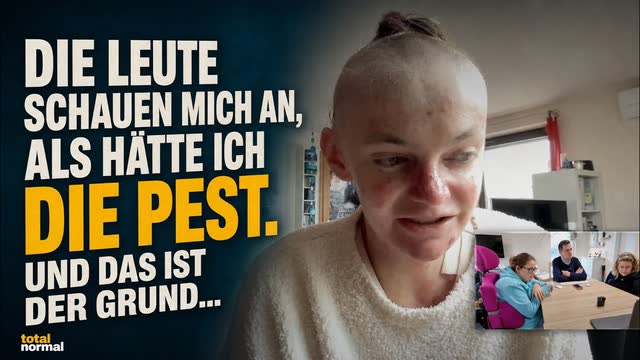 Folgencover: „Mitleid ist das Letzte, was ich möchte!“ — Clara über das Leben mit der Schmetterlingskrankheit